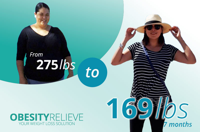 Gastric Sleeve Before & After 169 lbs
